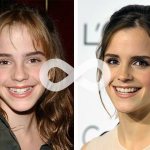 10 stars who wore braces - all about childhood diseases on IllnessNews.ru