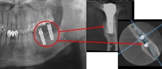 3d image of teeth