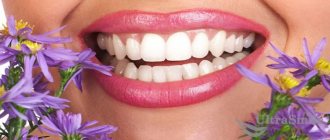 5 types of dental plaque: what does the color of the deposits mean?