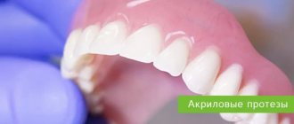 Acrylic dentures