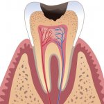 Alternative care products - how to brush your teeth if you don’t have toothpaste or a brush