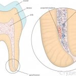 Amputation of dental pulp