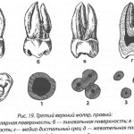 Анатомические особенности верхних зубов