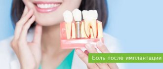 pain after dental implantation