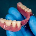 Pain after dentures