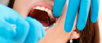 Gum pain after tooth extraction - Line of Smile Dentistry