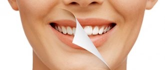 What you need to know about dental restoration