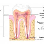 What is caries and its 4 stages