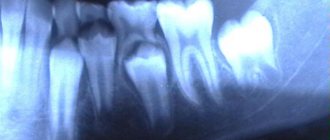 children&#39;s dental x-ray