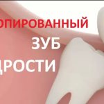 Дистопированный зуб мудрости удалить или вылечить