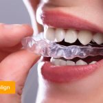 Фото кап Invisalign