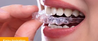 Фото кап Invisalign