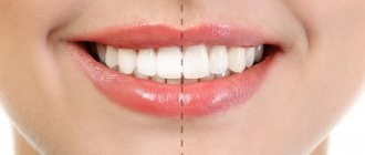 Photo of the proportional relationship between the sizes of the front teeth