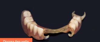 Photo of a removable denture without palate