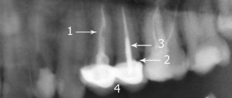 fragment of a panoramic photograph of teeth