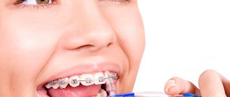 Hygiene when wearing braces