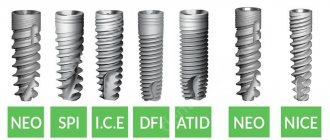 Alpha Bio NEO implants