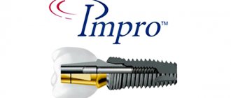 Dental implants