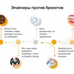 Инфографика о преимуществах элайнеров по сравнению с брекетами