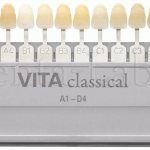 using the VITA scale to determine tooth color