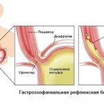 Изображение 1: ГЭРБ - клиника Семейный доктор