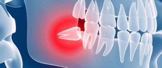 Figure 8 hood - Smile Line Dentistry