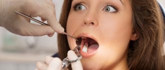 Local anesthesia - Dentistry Line Smile