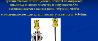 Vertical condensation method of hot gutta-percha