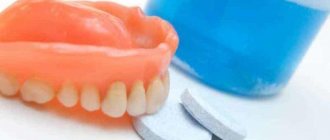 Do I need to remove dentures at night?