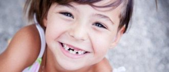 Pay attention to the distance between your child&#39;s teeth