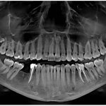 Orthopantomogram