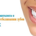 teeth whitening klox