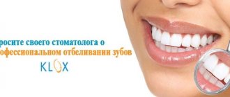 teeth whitening klox