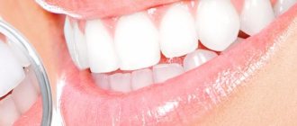 Teeth whitening Opalescence (Opalescence)