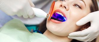 Teeth whitening with ultraviolet light