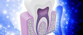 Causes of destruction of the enamel layer of teeth