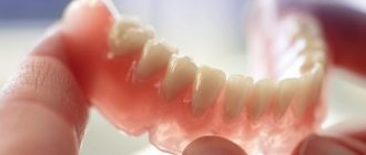 Various factors can cause a denture to darken.