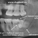 dental x-ray