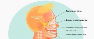 Симптомы невралгии тройничного нерва в картинках