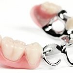 Modern clasp dentures