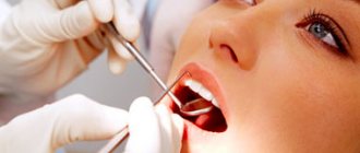 Dental hygiene indices - Hygiene indices in dentistry