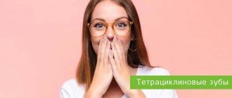 тетрациклиновые зубы