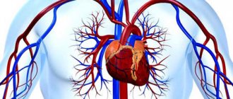 severe diseases of the cardiovascular system