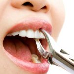 A tooth can be removed for many reasons