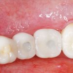 Conditions for prosthetics - Dentistry &quot;Smile Line&quot;