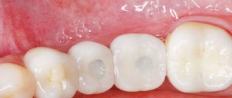 Conditions for prosthetics - Dentistry &quot;Smile Line&quot;