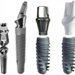 Types of Dental Implants