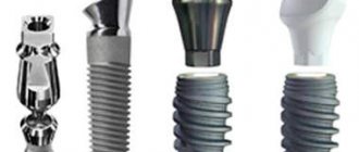 Types of Dental Implants