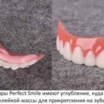 Veneers Perfect Smile (Perfect Smile Veneers). Real reviews, instructions on how to install 