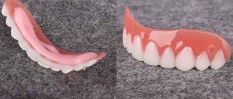 Виниры Перфект Смайл (Perfect Smile Veneers). Отзывы реальные, инструкция, как установить